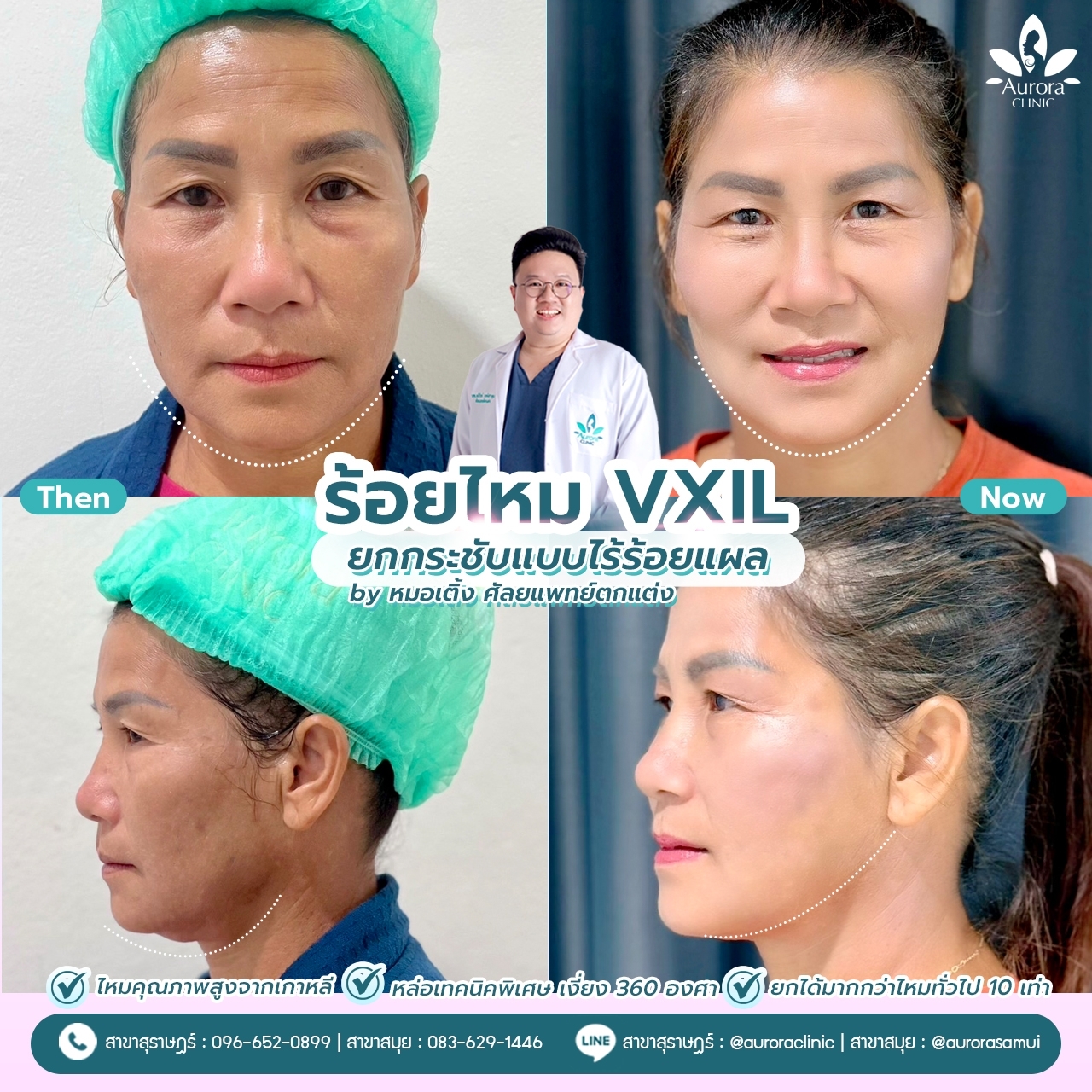 ร้อยไหม แก้ปัญหาอะไรได้บ้าง? ร้อยไหม แก้ปัญหาอะไรได้บ้าง?